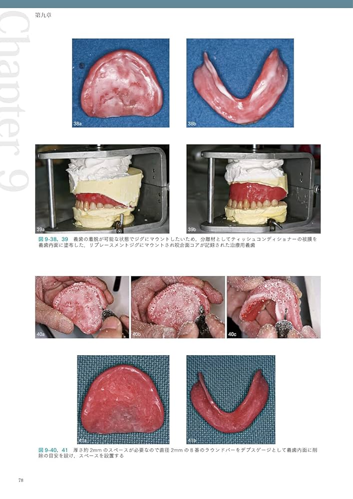 阿部晴彦の総義歯臨床 60年の臨床から導き出した阿部晴彦の総義歯臨床 | 阿部 晴彦